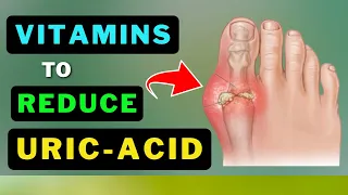 Fight Uric Acid Naturally: The 6 Vitamins You Can't Ignore