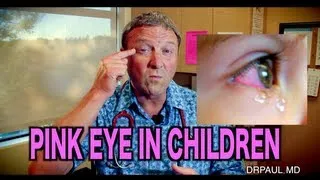 Pink Eye In Children | Pediatric Advice