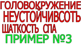 Головокружение СПА синдром позвоночной артерии  Шаткость Неустайчивость ПА панические атаки ПРИМЕР 3