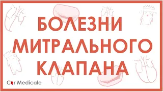 Болезни митрального клапана. Пролапс митрального клапана, стеноз, регургитация.