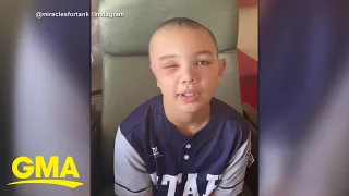 Little League player injured from bunk bed fall speaks out l GMA