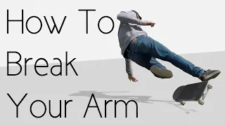 How To Break Your Arm The Easiest Way