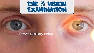 Examination of the Eyes and Vision - OSCE Guide (Old Version)
