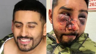 Man says he was beaten by Northern California sheriff's deputies | ABC7