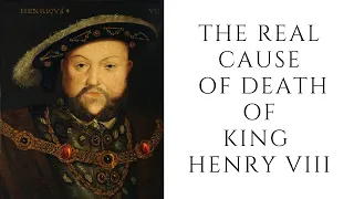 The REAL Cause Of Death Of King Henry VIII