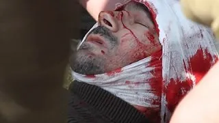 Raw: Russian Journalist Hurt in Eastern Ukraine