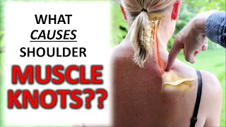 What CAUSES Muscle Knots In Your Shoulders, Traps & Upper Back?