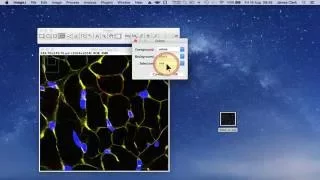 Using ImageJ to measure cell number and cross-sectional area of confocal images