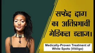 सफ़ेद दाग का इलाज़।White Spots Treatment | Safed Daag ka Ilaaz| by Skinaa Clinic #WhiteSpots #Vitiligo