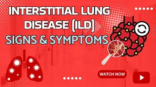 Interstitial Lung Disease Signs and Symptoms