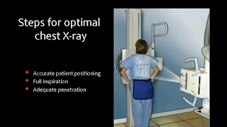 1 chest x ray - prof.Mamdouh Mahfouz (2019 edition)