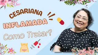 Cesárea Inflamada - Patricia Amorim por Famivita