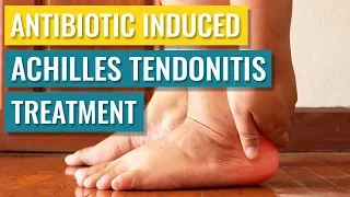 Antibiotic (Cipro) Induced Achilles Tendonitis Treatment