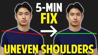 Fix Uneven Shoulders, Scoliosis｜With Just 5-Minutes｜Fix the Shoulders