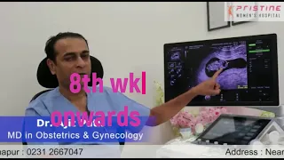 first sonography during pregnancy