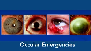 Occular Emergencies || Ophthalmic Emergencies