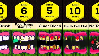 Timeline: If You Never Brush Your Teeth