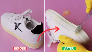 How to Remove Yellow Stains from White Shoes Sole