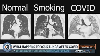 Here's what happens to your lungs when you get COVID