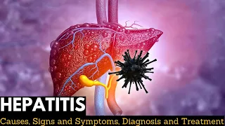 Hepatitis, Causes, Signs and Symptoms, Diagnosis and Treatment.