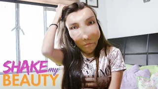 I Won't Hide My Facial Deformity | SHAKE MY BEAUTY