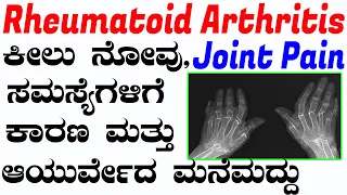 Rheumatoid Arthritis Ayurvedic Treatment in Kannada  Ananth ji|Ayurveda tips in Kannada|Media Master