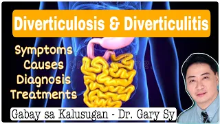 Diverticulosis and Diverticulitis- Dr. Gary Sy