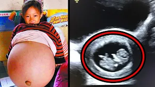 8-Year-Old Girl Is Told She Looks Pregnant in School. Her Parents Rush Her for an Ultrasound