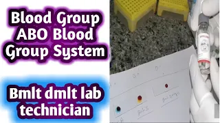 Blood groups practical | Blood grouping test | ABO Blood Group System | Rh System