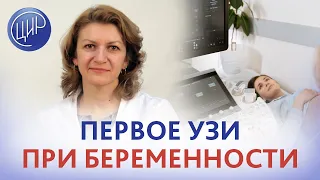 Первое УЗИ при беременности. Когда делать первое УЗИ и первую допплерометрию при беременности?