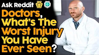 Doctors, What's The Worst Injury You've Seen?