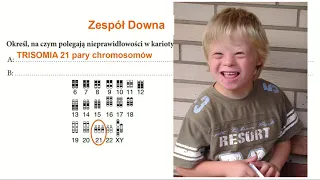 Biologia - LO - matura. Choroby genetyczne chromosomowe