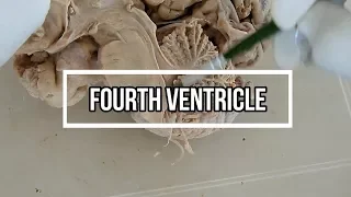 Fourth ventricle / neuroanatomy / floor / opening