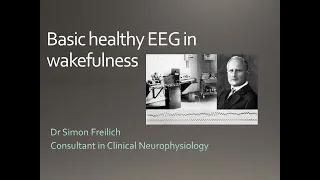 EEG - The alpha rhythm