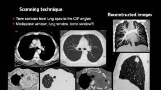 Pediatric Chest Radiology (In Arabic)