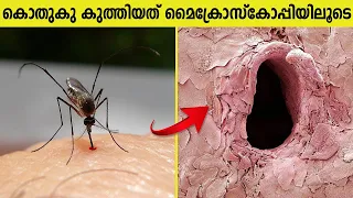 നിങ്ങളെ ആശ്ചര്യപ്പെടുത്തുന്ന മൈക്രോസ്കോപ്പിക് കാഴ്ചകൾ കണ്ടാലോ ? Things You Can See Under Microscope