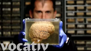 Belgium's Giant Brain Collection Could Help Treat Diseases