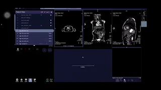 MRI CARDIAC Siemens 1.5 Tesla sempra BY / MR . Ehab Magdy  رنين مغناطيسي علي  القلب