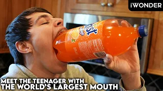 This Teenager Has The World's Biggest Mouth Gape