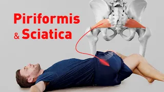 Piriformis Syndrome & Sciatica - Stretching Exercises