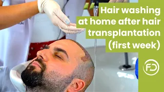Hair Washing Procedure at Home After Hair Transplantation (First Week) - Tutorial
