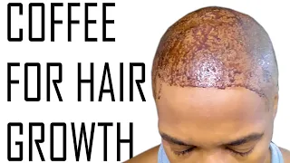 Use Regular Coffee To Accelerate Hair Growth | How I Did It