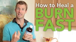 How to Ease a Burn Fast