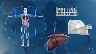 How is Cancer Diagnosed? | Central Principles of Molecular Biology