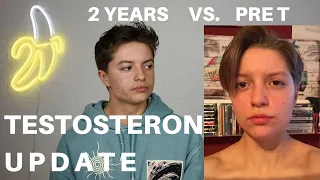 TESTOSTERON UPDATE 2 JAHRE - ftm transgender