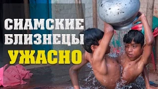 ТОП10 СИАМСКИЕ БЛИЗНЕЦЫ