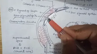 Uveal tract (clinical anatomy )simplified