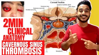 thrombosis of cavernous sinus anatomy | dangerous area of face clinical anatomy of cavernous sinus