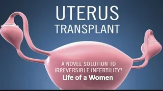 Womb Transplant in the Life of a Women