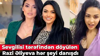 Sevgilisi tərəfindən döyülən Razi Əliyeva hər şeyi danışdı